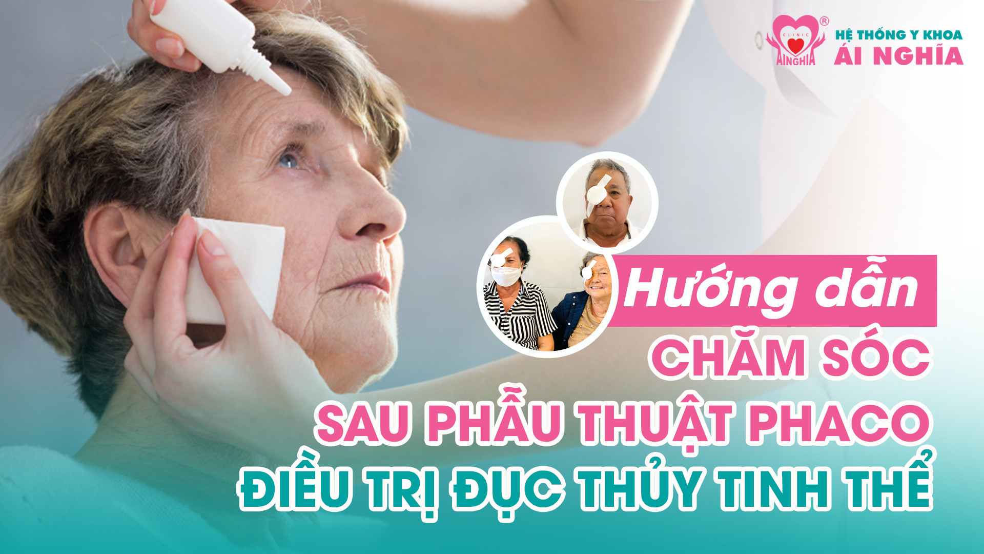 Hướng dẫn chăm sóc sau Phẫu thuật Phaco (điều trị Đục thủy tinh thể)
