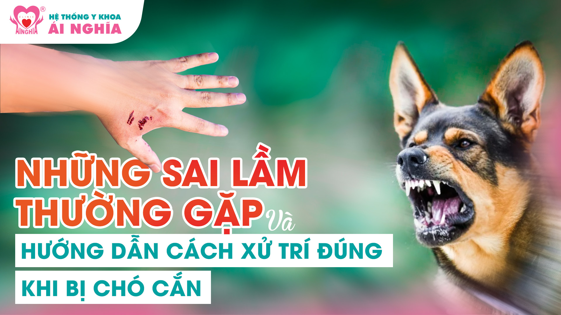 Sai lầm thường gặp và hướng dẫn các xử trí đúng khi bị chó cắn