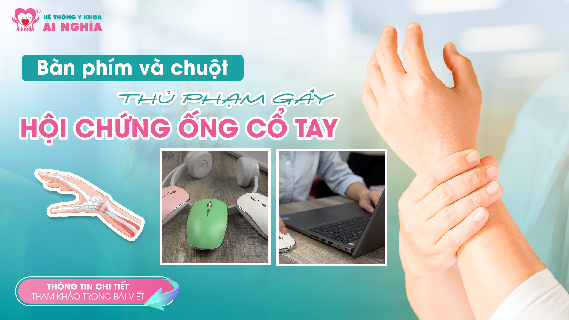 Bàn phím, chuột – nguyên nhân hàng đầu có thể gây hội chứng ống cổ tay