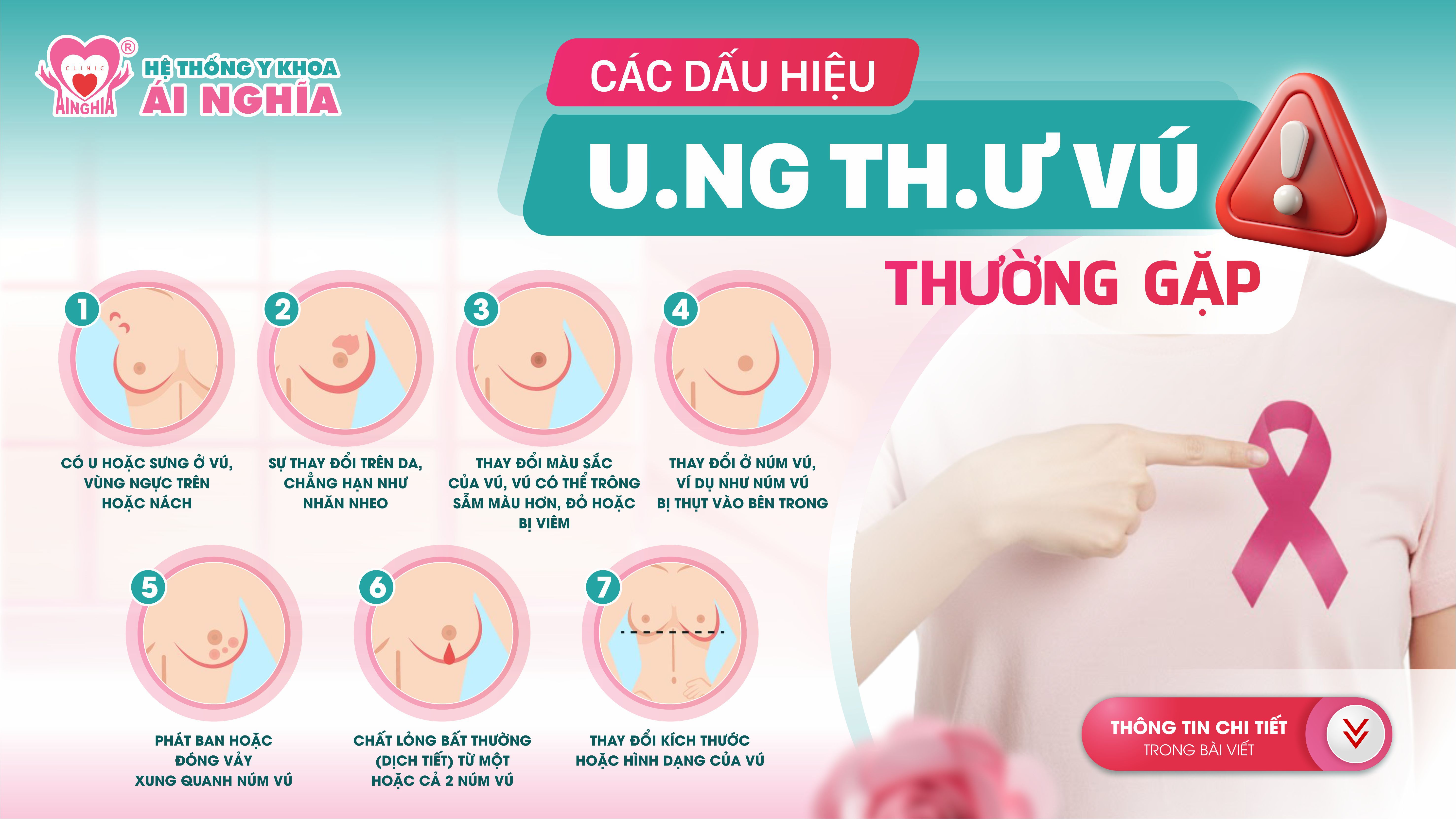 Nhận biết sớm 7 dấu hiệu ung thư vú thường gặp