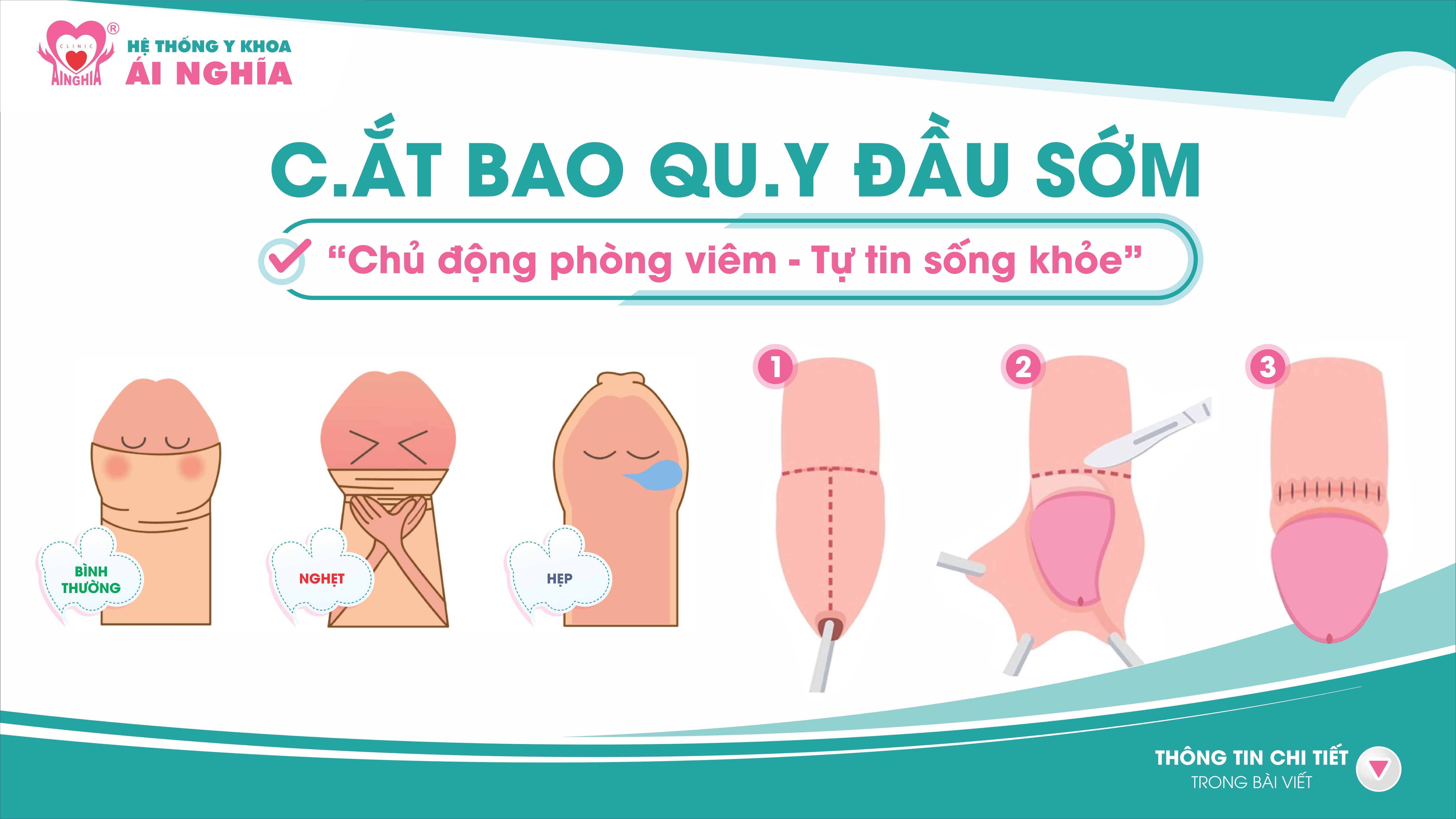 Cắt Bao Quy Đầu Sớm – Nâng Cao Chất Lượng Cuộc Sống